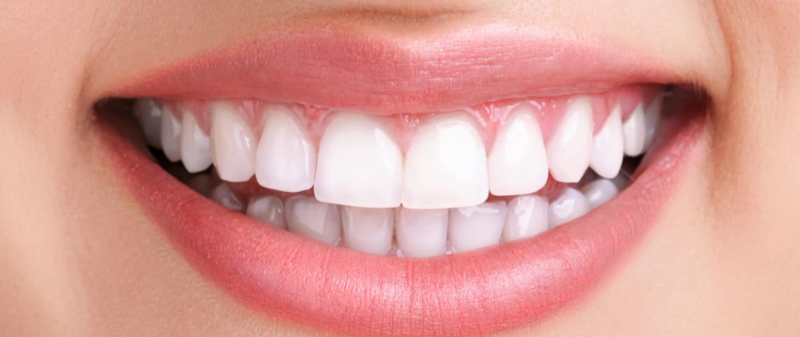 teeth whitening in bangalore