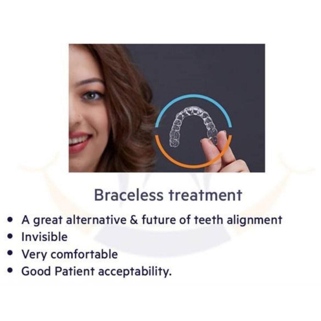 Invisible Braces / Clear Aligners in Vijayanagar​