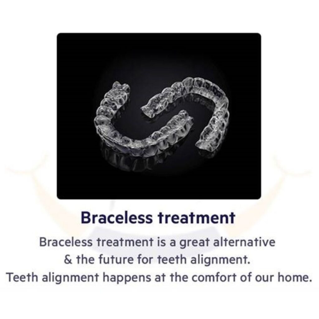 Invisible Braces / Clear Aligners in Bangalore​