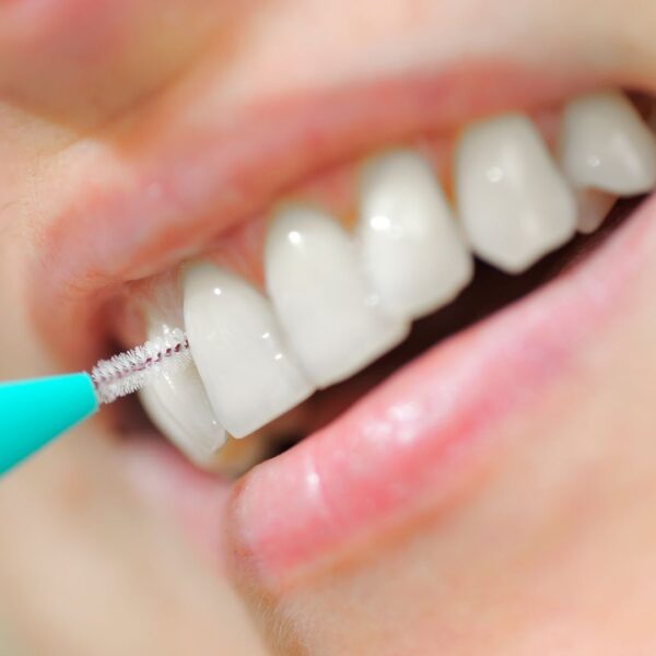 dental blog 5