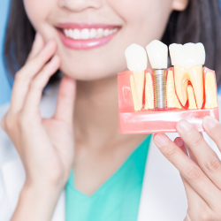 Bone Grafting & Sinus Lift for Implants: When and Why?